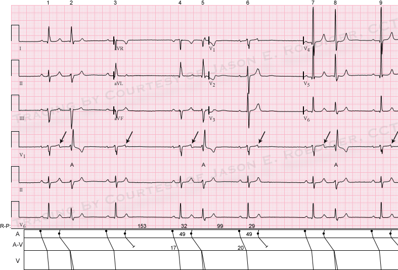 APB ECG Guru Instructor Resources